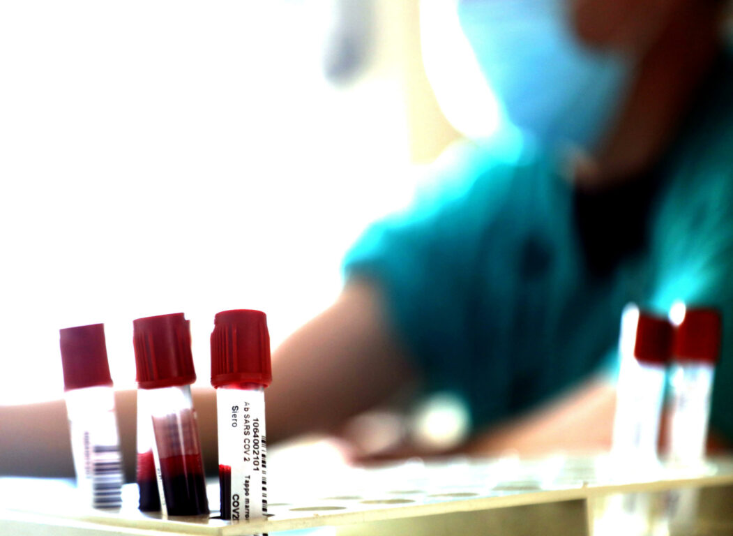 Isolati 'super anticorpi', svolta per cure Isolati 'super anticorpi', svolta per cure